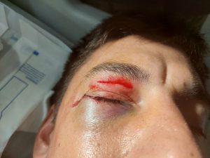 Golpe a Bruna